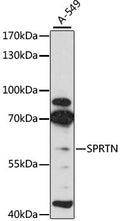Western blot analysis of extracts of A-549 cells, using SPRTN antibody  at 1:3000 dilution.
Secondary antibody: HRP Goat…