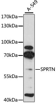 Western blot analysis of extracts of A-549 cells, using SPRTN antibody  at 1:3000 dilution.
Secondary antibody: HRP Goat…