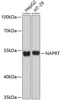 Western blot analysis of extracts of various cell lines, using NAPRT Antibody  at 1:3000 dilution.
Secondary antibody: HRP Goat Anti-Rabbit IgG   at 1:10000 dilution.
Lysates/proteins: 25ug per lane.
Blocking buffer: 3% nonfat dry milk in TBST.
Detection: ECL Basic Kit .
Exposure time: 30s.