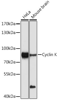 Western blot analysis of extracts of various cell lines, using Cyclin K Antibody  at 1:1000 dilution.
Secondary antibody: HRP Goat Anti-Rabbit IgG   at 1:10000 dilution.
Lysates/proteins: 25ug per lane.
Blocking buffer: 3% nonfat dry milk in TBST.
Detection: ECL Enhanced Kit .
Exposure time: 90s.