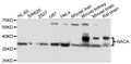 Western blot analysis of extracts of various cell lines, using NACA antibody at 1:1000 dilution.