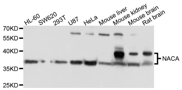 Western blot analysis of extracts of various cell lines, using NACA antibody at 1:1000 dilution.