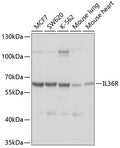 Western blot analysis of extracts of various cell lines, using IL1RL2 antibody  at 1:1000 dilution.
Secondary antibody: HRP Goat Anti-Rabbit IgG   at 1:10000 dilution.
Lysates/proteins: 25ug per lane.
Blocking buffer: 3% nonfat dry milk in TBST.
Detection: ECL Basic Kit .
Exposure time: 15s.