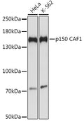 Western blot analysis of extracts of various cell lines, using p150 CAF1 antibody  at 1:1000 dilution.
Secondary antibody: HRP Goat Anti-Rabbit IgG   at 1:10000 dilution.
Lysates/proteins: 25ug per lane.
Blocking buffer: 3% nonfat dry milk in TBST.
Detection: ECL Basic Kit .
Exposure time: 5s.