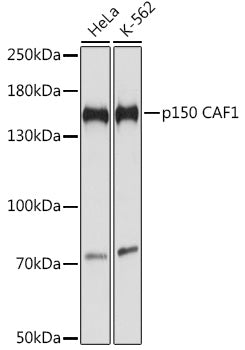 Western blot analysis of extracts of various cell lines, using p150 CAF1 antibody  at 1:1000 dilution.
Secondary antibody: HRP Goat Anti-Rabbit IgG   at 1:10000 dilution.
Lysates/proteins: 25ug per lane.
Blocking buffer: 3% nonfat dry milk in TBST.
Detection: ECL Basic Kit .
Exposure time: 5s.