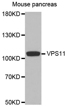 Western blot analysis of extracts of mouse pancreas, using VPS11 antibody.