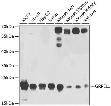 Western blot analysis of extracts of various cell lines, using GRPEL1 antibody  at 1:1000 dilution.
Secondary antibody: HRP…