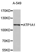 Na+/K+-ATPase polyclonal antibody – Figure 1 of 2