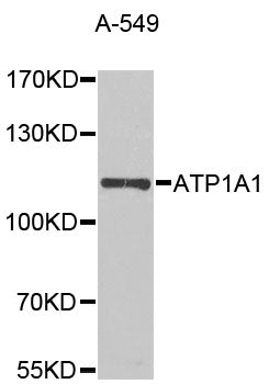 Na+/K+-ATPase polyclonal antibody – Figure 1 of 2