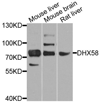 Western blot analysis of extracts of various cell lines, using DHX58 antibody.