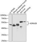 ADRA2B polyclonal antibody – Figure 1 of 1