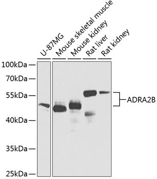 ADRA2B polyclonal antibody – Figure 1 of 1