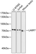 Western blot analysis of extracts of various cell lines, using LARP7 antibody  at 1:3000 dilution.
Secondary antibody: HRP Goat Anti-Rabbit IgG   at 1:10000 dilution.
Lysates/proteins: 25ug per lane.
Blocking buffer: 3% nonfat dry milk in TBST.
Detection: ECL Basic Kit .
Exposure time: 90s.