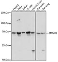 Western blot analysis of extracts of various cell lines, using MTMR9 antibody  at 1:3000 dilution.
Secondary antibody: HRP Goat Anti-Rabbit IgG   at 1:10000 dilution.
Lysates/proteins: 25ug per lane.
Blocking buffer: 3% nonfat dry milk in TBST.
Detection: ECL Basic Kit .
Exposure time: 10s.