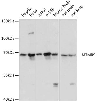 Western blot analysis of extracts of various cell lines, using MTMR9 antibody  at 1:3000 dilution.
Secondary antibody: HRP Goat Anti-Rabbit IgG   at 1:10000 dilution.
Lysates/proteins: 25ug per lane.
Blocking buffer: 3% nonfat dry milk in TBST.
Detection: ECL Basic Kit .
Exposure time: 10s.
