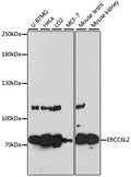 Western blot analysis of extracts of various cell lines, using ERCC6L2 antibody  at 1:3000 dilution.
Secondary antibody: HRP Goat Anti-Rabbit IgG   at 1:10000 dilution.
Lysates/proteins: 25ug per lane.
Blocking buffer: 3% nonfat dry milk in TBST.
Detection: ECL Enhanced Kit .
Exposure time: 60s.