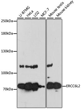 Western blot analysis of extracts of various cell lines, using ERCC6L2 antibody  at 1:3000 dilution.
Secondary antibody: HRP Goat Anti-Rabbit IgG   at 1:10000 dilution.
Lysates/proteins: 25ug per lane.
Blocking buffer: 3% nonfat dry milk in TBST.
Detection: ECL Enhanced Kit .
Exposure time: 60s.