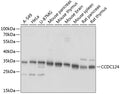 Western blot analysis of extracts of various cell lines, using CCDC124 antibody  at 1:1000 dilution.
Secondary antibody: HRP Goat Anti-Rabbit IgG   at 1:10000 dilution.
Lysates/proteins: 25ug per lane.
Blocking buffer: 3% nonfat dry milk in TBST.
Detection: ECL Basic Kit .
Exposure time: 1s.