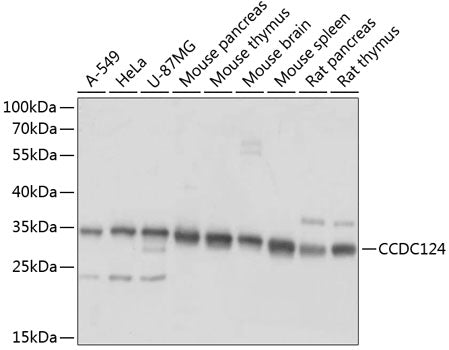 Western blot analysis of extracts of various cell lines, using CCDC124 antibody  at 1:1000 dilution.
Secondary antibody: HRP Goat Anti-Rabbit IgG   at 1:10000 dilution.
Lysates/proteins: 25ug per lane.
Blocking buffer: 3% nonfat dry milk in TBST.
Detection: ECL Basic Kit .
Exposure time: 1s.