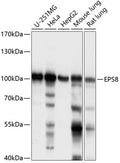 Western blot analysis of extracts of various cell lines, using EPS8 antibody  at 1:1000 dilution.
Secondary antibody: HRP Goat Anti-Rabbit IgG   at 1:10000 dilution.
Lysates/proteins: 25ug per lane.
Blocking buffer: 3% nonfat dry milk in TBST.
Detection: ECL Enhanced Kit .
Exposure time: 1s.