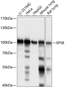 Western blot analysis of extracts of various cell lines, using EPS8 antibody  at 1:1000 dilution.
Secondary antibody: HRP Goat Anti-Rabbit IgG   at 1:10000 dilution.
Lysates/proteins: 25ug per lane.
Blocking buffer: 3% nonfat dry milk in TBST.
Detection: ECL Enhanced Kit .
Exposure time: 1s.