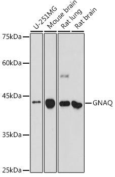 Western blot analysis of extracts of various cell lines, using GNAQ antibody  at 1:500 dilution.
Secondary antibody: HRP Goat Anti-Rabbit IgG   at 1:10000 dilution.
Lysates/proteins: 25ug per lane.
Blocking buffer: 3% nonfat dry milk in TBST.
Detection: ECL Enhanced Kit .
Exposure time: 180s.