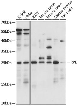 Western blot analysis of extracts of various cell lines, using RPE antibody  at 1:1000 dilution.
Secondary antibody: HRP Goat Anti-Rabbit IgG   at 1:10000 dilution.
Lysates/proteins: 25ug per lane.
Blocking buffer: 3% nonfat dry milk in TBST.
Detection: ECL Basic Kit .
Exposure time: 5s.