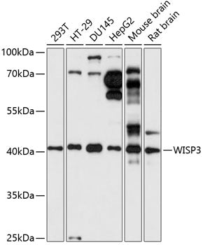 Western blot analysis of extracts of various cell lines, using WISP3 antibody  at 1:1000 dilution.
Secondary antibody: HRP Goat Anti-Rabbit IgG   at 1:10000 dilution.
Lysates/proteins: 25ug per lane.
Blocking buffer: 3% nonfat dry milk in TBST.
Detection: ECL Basic Kit .
Exposure time: 30s.