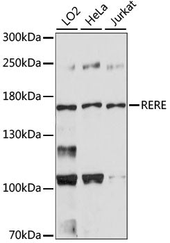 Western blot analysis of extracts of various cell lines, using RERE antibody .
Secondary antibody: HRP Goat Anti-Rabbit IgG   at 1:10000 dilution.
Lysates/proteins: 25ug per lane.
Blocking buffer: 3% nonfat dry milk in TBST.
Detection: ECL Basic Kit .
Exposure time: 90s.