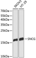 Western blot (WB) analysis of Synoretin polyclonal antibody