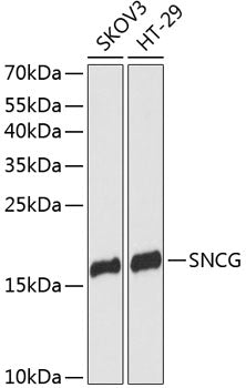 Western blot (WB) analysis of Synoretin polyclonal antibody