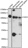 Western blot analysis of extracts of various cell lines, using VAV3 antibody  at 1:1000 dilution.
Secondary antibody: HRP Goat Anti-Rabbit IgG   at 1:10000 dilution.
Lysates/proteins: 25ug per lane.
Blocking buffer: 3% nonfat dry milk in TBST.
Detection: ECL Basic Kit .
Exposure time: 2s.