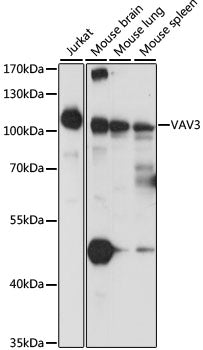 Western blot analysis of extracts of various cell lines, using VAV3 antibody  at 1:1000 dilution.
Secondary antibody: HRP Goat Anti-Rabbit IgG   at 1:10000 dilution.
Lysates/proteins: 25ug per lane.
Blocking buffer: 3% nonfat dry milk in TBST.
Detection: ECL Basic Kit .
Exposure time: 2s.