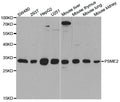 Western blot (WB) analysis of PSME2 polyclonal antibody