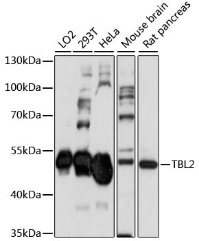 Western blot analysis of extracts of various cell lines, using TBL2 antibody  at 1:1000 dilution.
Secondary antibody: HRP Goat Anti-Rabbit IgG   at 1:10000 dilution.
Lysates/proteins: 25ug per lane.
Blocking buffer: 3% nonfat dry milk in TBST.
Detection: ECL Enhanced Kit .
Exposure time: 90s.