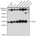 Western blot analysis of extracts of various cell lines, using TACO1 antibody  at 1:1000 dilution.
Secondary antibody: HRP…