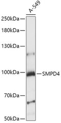 Western blot analysis of extracts of A-549 cells, using SMPD4 antibody  at 1:1000 dilution.
Secondary antibody: HRP Goat Anti-Rabbit IgG   at 1:10000 dilution.
Lysates/proteins: 25ug per lane.
Blocking buffer: 3% nonfat dry milk in TBST.
Detection: ECL Basic Kit .
Exposure time: 15s.