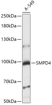 Western blot analysis of extracts of A-549 cells, using SMPD4 antibody  at 1:1000 dilution.
Secondary antibody: HRP Goat Anti-Rabbit IgG   at 1:10000 dilution.
Lysates/proteins: 25ug per lane.
Blocking buffer: 3% nonfat dry milk in TBST.
Detection: ECL Basic Kit .
Exposure time: 15s.