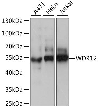 Western blot analysis of extracts of various cell lines, using WDR12 antibody  at 1:1000 dilution.
Secondary antibody: HRP Goat Anti-Rabbit IgG   at 1:10000 dilution.
Lysates/proteins: 25ug per lane.
Blocking buffer: 3% nonfat dry milk in TBST.
Detection: ECL Basic Kit .
Exposure time: 30s.