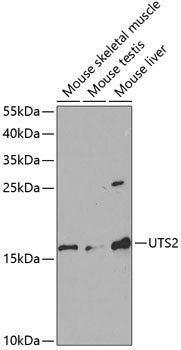 Western blot (WB) analysis of Urotensin II polyclonal antibody