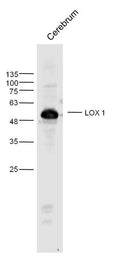 Sample: Cerebrum (Rat) Lysate at 40 ug
Primary: Anti- LOX1 at 1/300 dilution