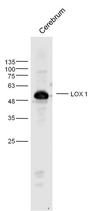 Sample: Cerebrum (Rat) Lysate at 40 ug
Primary: Anti- LOX1 at 1/300 dilution