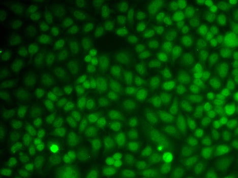 Western blot analysis of extracts of various cell lines, using GADD45A antibody  at  1:602 dilution.
Secondary antibody: HRP Goat Anti-Rabbit IgG   at 1:10000 dilution.
Lysates/proteins: 25ug per lane.
Blocking buffer: 3% nonfat dry milk in TBST.
Detection: ECL Basic Kit .
Exposure time: 30s.