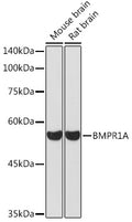 Western blot analysis of extracts of various cell lines, using BMPR1A Rabbit pAb  at 1:1000 dilution.
Secondary antibody: HRP Goat Anti-Rabbit IgG   at 1:10000 dilution.
Lysates/proteins: 25ug per lane.
Blocking buffer: 3% nonfat dry milk in TBST.
Detection: ECL Basic Kit .
Exposure time: 30s.