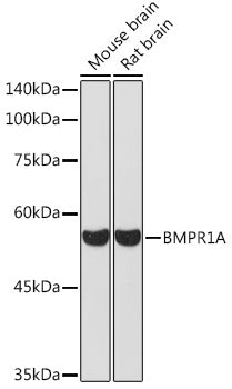 Western blot analysis of extracts of various cell lines, using BMPR1A Rabbit pAb  at 1:1000 dilution.
Secondary antibody: HRP Goat Anti-Rabbit IgG   at 1:10000 dilution.
Lysates/proteins: 25ug per lane.
Blocking buffer: 3% nonfat dry milk in TBST.
Detection: ECL Basic Kit .
Exposure time: 30s.