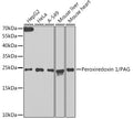 Western blot analysis of extracts of various cell lines, using Peroxiredoxin 1/PAG antibody  at 1:1000 dilution.
Secondary antibody: HRP Goat Anti-Rabbit IgG   at 1:10000 dilution.
Lysates/proteins: 25ug per lane.
Blocking buffer: 3% nonfat dry milk in TBST.