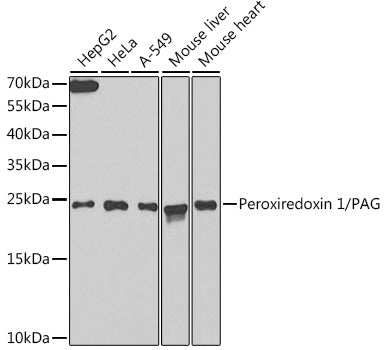 Western blot analysis of extracts of various cell lines, using Peroxiredoxin 1/PAG antibody  at 1:1000 dilution.
Secondary antibody: HRP Goat Anti-Rabbit IgG   at 1:10000 dilution.
Lysates/proteins: 25ug per lane.
Blocking buffer: 3% nonfat dry milk in TBST.
