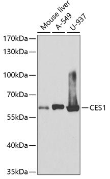 Western blot analysis of extracts of various cell lines, using CES1 antibody  at 1:1000 dilution.
Secondary antibody: HRP Goat Anti-Rabbit IgG   at 1:10000 dilution.
Lysates/proteins: 25ug per lane.
Blocking buffer: 3% nonfat dry milk in TBST.