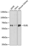 Western blot analysis of extracts of various cell lines, using GLB1  antibody  at 1:1000 dilution.
Secondary antibody: HRP Goat Anti-Rabbit IgG   at 1:10000 dilution.
Lysates/proteins: 25ug per lane.
Blocking buffer: 3% nonfat dry milk in TBST.
Detection: ECL Basic Kit .
Exposure time: 90s.