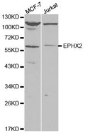 Western blot (WB) analysis of EPHX2 polyclonal antibody
